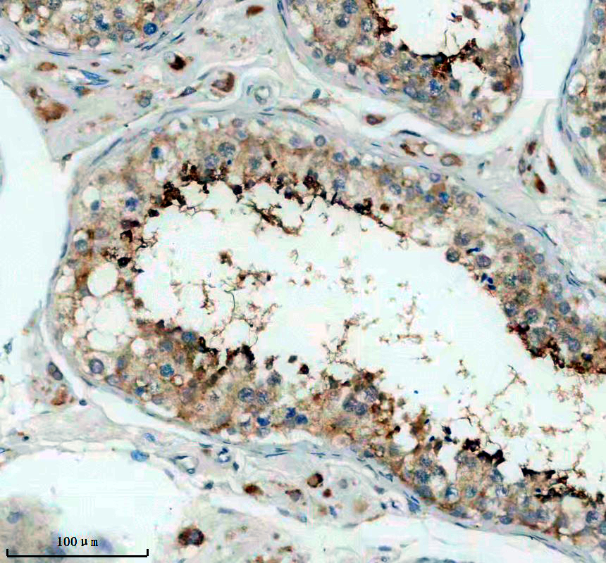 a07161 1 akap3 primary antibodies ihc testing 1