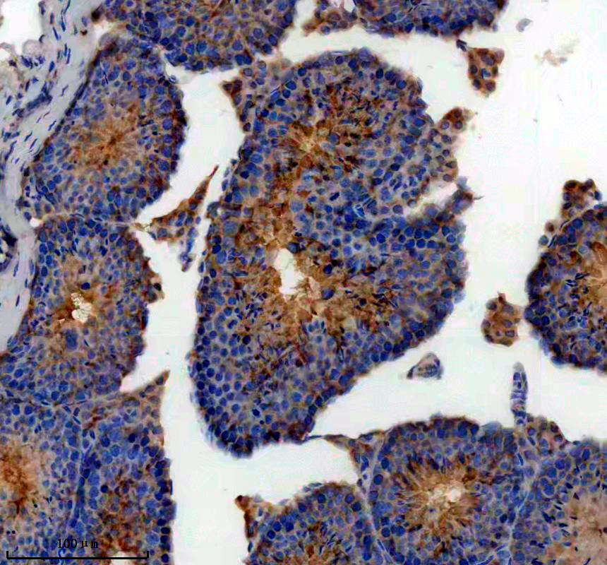 a07161 1 akap3 primary antibodies ihc testing 2
