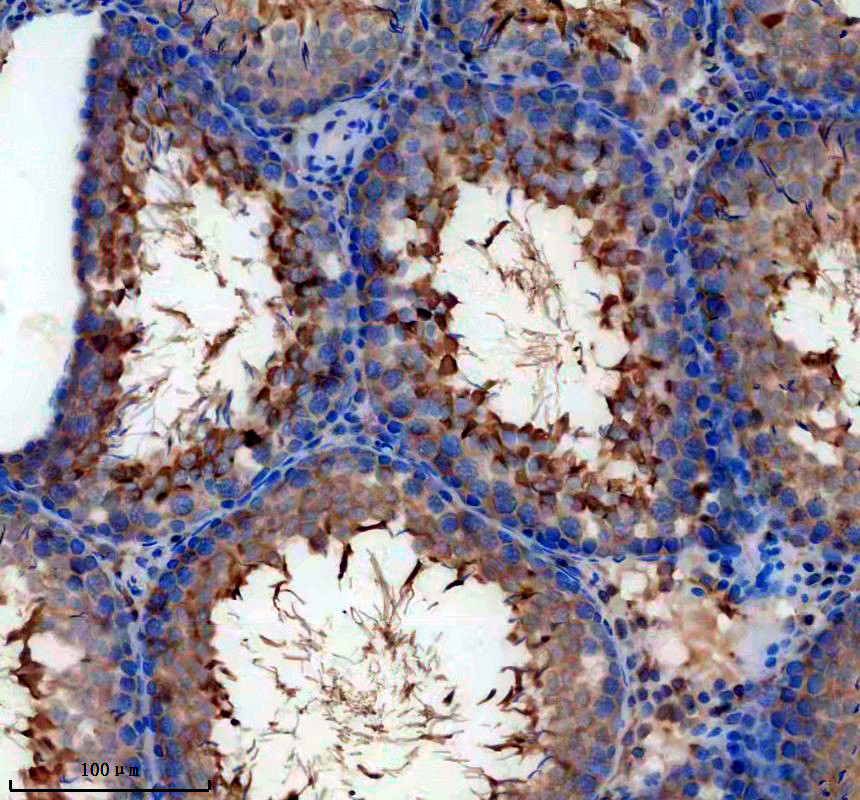 a07161 1 akap3 primary antibodies ihc testing 3