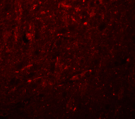 Immunofluorescence of TRESK in Rat Brain cells with TRESK antibody at 20 μg/mL
