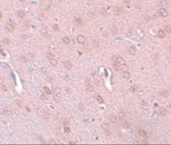 Immunohistochemistry of TRESK in rat brain tissue with TRESK antibody at 5 μg/mL