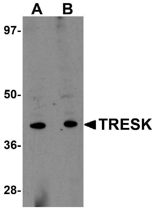 Western blot analysis of TRESK in rat brain tissue lysate with TRESK antibody at (A) 1 and (B) 2 μg/mL