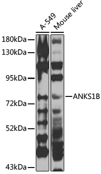a07165 anks1b primary antiboties wb testing 1
