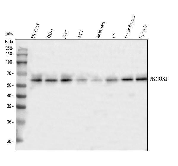 Western blot analysis of PKNOX1 using anti-PKNOX1 antibody (A07166-1)