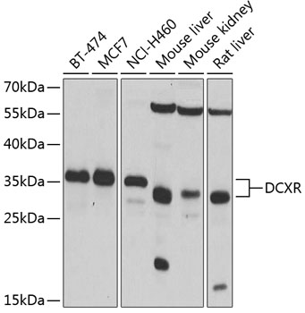 a07170 dcxr primary antiboties wb testing 1