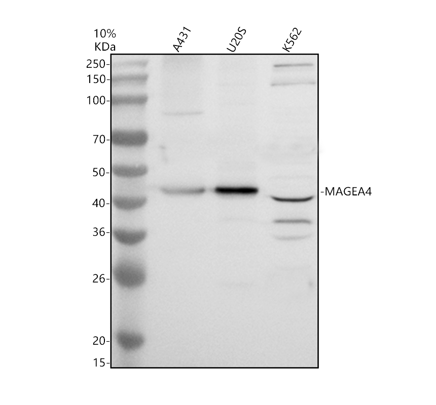 Western blot analysis of MAGEA4 using anti-MAGEA4 antibody (A07175-1)