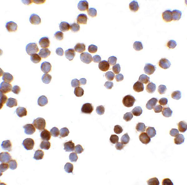 a07175 magea4 primary antibodies icc testing 5