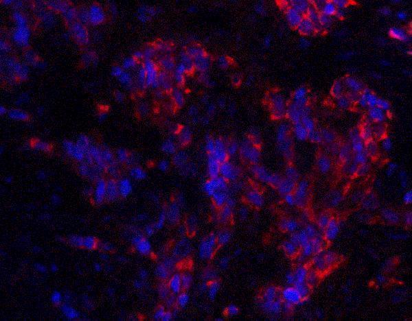 a07175 magea4 primary antibodies if testing 4