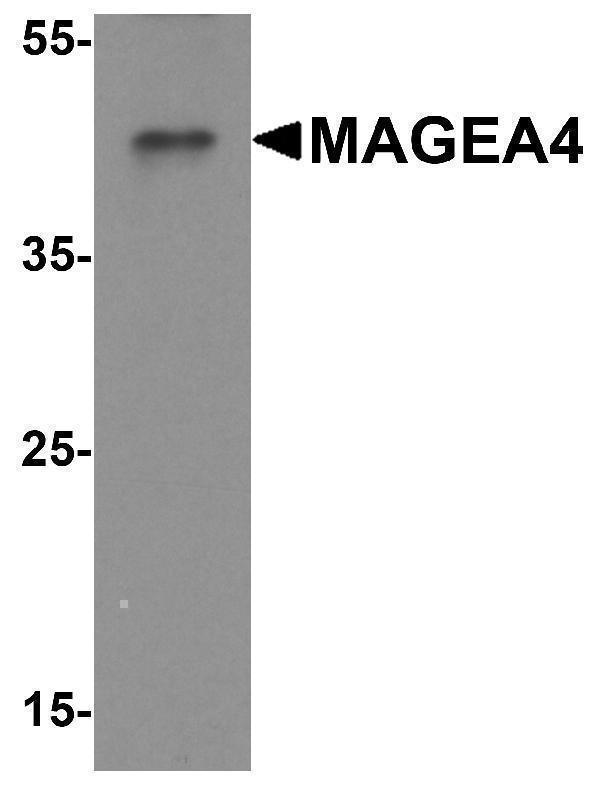 Western blot analysis of MAGEA4 in A431 cell lysate with MAGEA4 antibody at 1 μg/ml