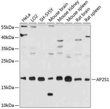 a07176 ap2s1 primary antiboties wb testing 1