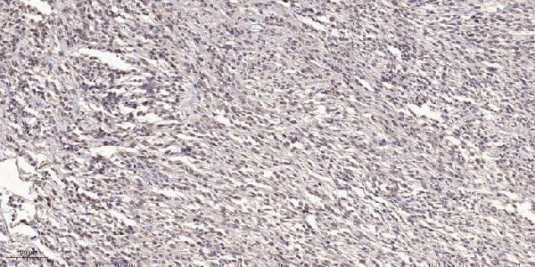 a07177 1 arrdc3 primary antibodies ihc testing 1