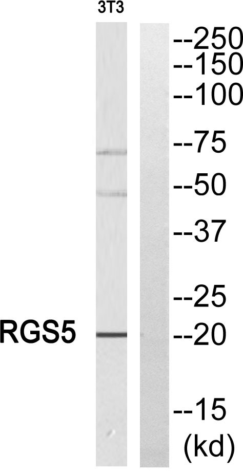 Western blot analysis of RGS5 Antibody