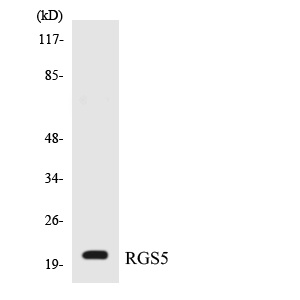 Western blot analysis of the lysates from HepG2 cells using RGS5 antibody