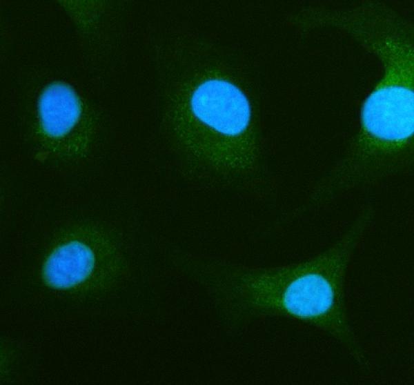IF analysis of CHCHD4 using anti-CHCHD4 antibody (A07179-1)