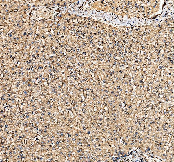 IHC analysis of CHCHD4 using anti-CHCHD4 antibody (A07179-1)