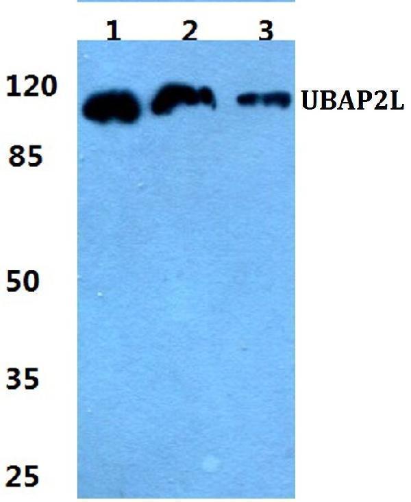 Western blot (WB) analysis of UBAP2L polyclonal antibody at 1:500 dilution
Lane1:MCF-7 cell lysate
Lane2:sp2/0 cell lysate
Lane3:H9C2 cell lysate