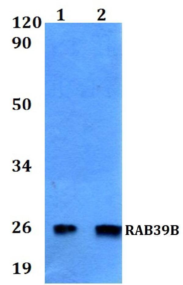 Western blot (WB) analysis of RAB39B polyclonal antibody at 1:500 dilution
Lane1:MCF-7 whole cell lysate
Lane2:H9C2 whole cell lysate 