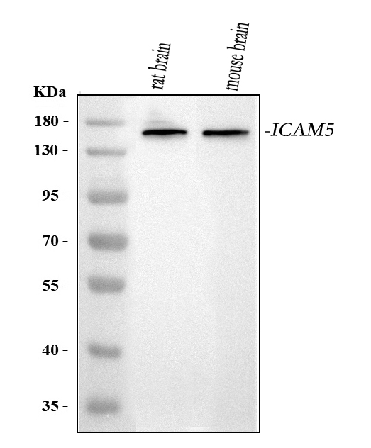  Western blot analysis of ICAM5 using anti-ICAM5 antibody (A07187-2)