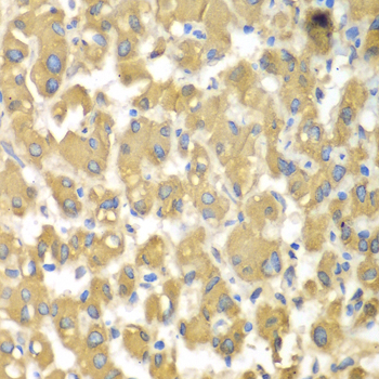 a07188 1 map4k3 primary antiboties ihc testing 2