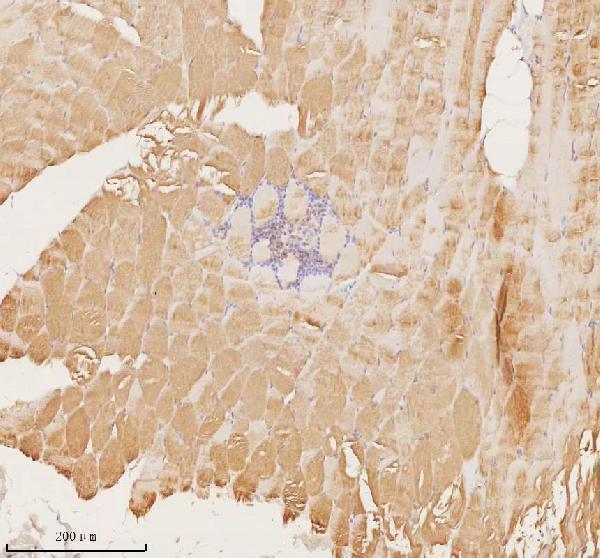  IHC analysis of MAP4K3 using anti-MAP4K3 antibody (A07188-2)
