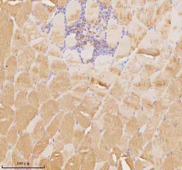  IHC analysis of MAP4K3 using anti-MAP4K3 antibody (A07188-2)