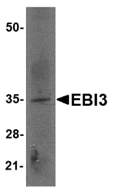 a07190 1 ebi3 primary antibodies wb testing 1