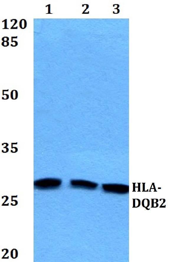 Western blot (WB) analysis of HLA-DQB2 polyclonal antibody at 1:500 dilution
Lane1:HEK293T whole cell lysate
Lane2:MCF-7 whole cell lysate
Lane3:Raw264