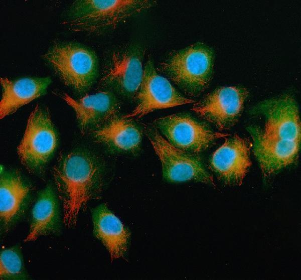 a07194 gcnt2 primary antibodies if testing 1
