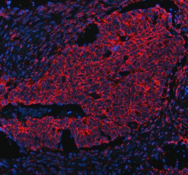 a07194 gcnt2 primary antibodies if testing 2