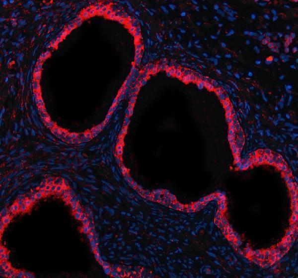 a07194 gcnt2 primary antibodies if testing 3