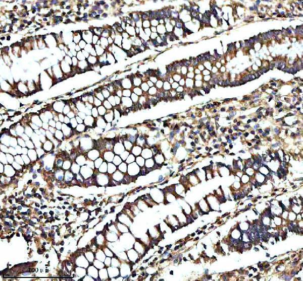 a07194 gcnt2 primary antibodies ihc testing 1
