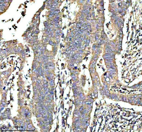 IHC analysis of GCNT2 using anti-GCNT2 antibody (A07194)