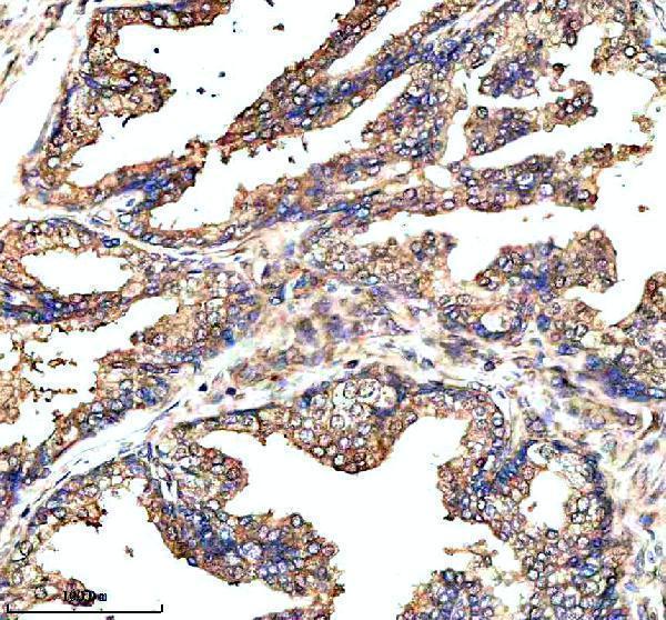 IHC analysis of GCNT2 using anti-GCNT2 antibody (A07194)