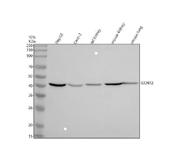 Western blot analysis of GCNT2 using anti-GCNT2 antibody (A07194)