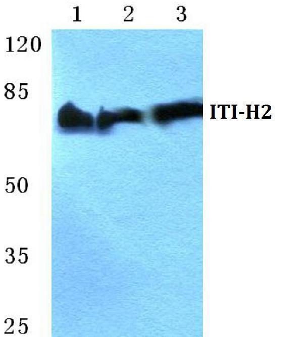 a07196 1 itih2 primary antiboties wb testing 1