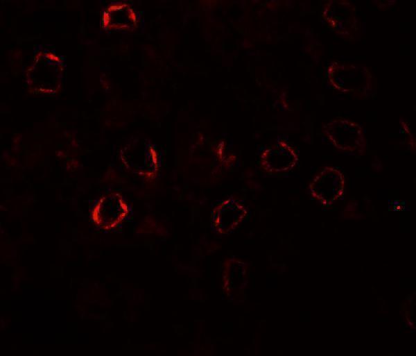a07202 kirrel3 primary antibodies if testing 3