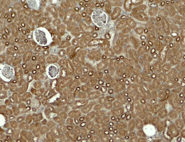 a07202 kirrel3 primary antibodies ihc testing 2