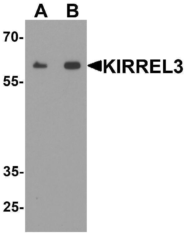 a07202 kirrel3 primary antibodies wb testing 1