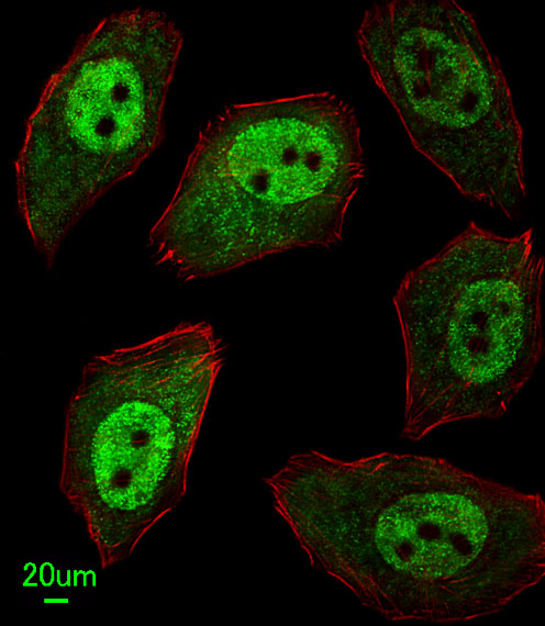 Immunofluorescent analysis of U251 cells, using APEX2 Antibody (Center)