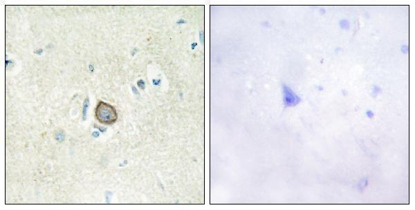 Immunohistochemistry analysis of paraffin-embedded human brain tissue, using CELSR3 Antibody