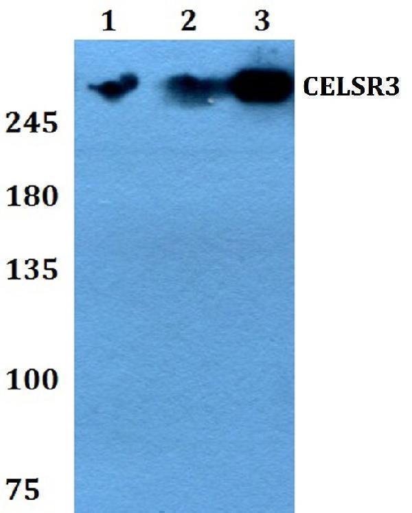 Western blot (WB) analysis of CELSR3 polyclonal antibody at 1:500 dilution
Lane1:HEK293T whole cell lysate
Lane2:sp2/0 whole cell lysate 
Lane3:PC12 whole cell lysate 