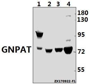 Western blot (WB) analysis of GNPAT (F365) pAb at 1:500 dilution
Lane1:3T3-L1 whole cell lysate(40ug)
Lane2:H9C2 whole cell lysate(40ug)
Lane3:PC3 whole cell lysate(40ug)
Lane4:Hela whole cell lysate(40ug)