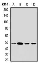 Western blot analysis of ACADL expression in SHSY5Y (A), mouse liver (B), mouse heart (C), rat spinal cord (D) whole cell lysates