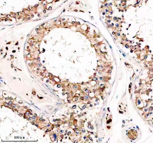 IHC analysis of TRIM59 using anti-TRIM59 antibody (A07207-2)