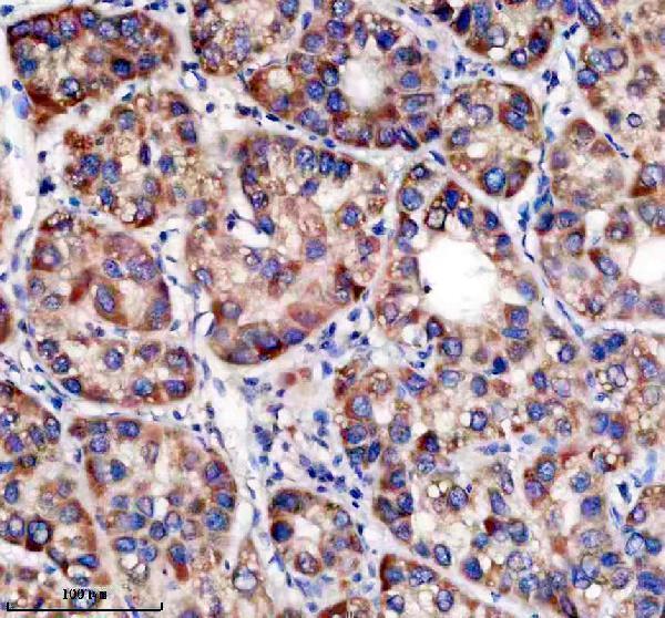 IHC analysis of TRIM59 using anti-TRIM59 antibody (A07207-2)