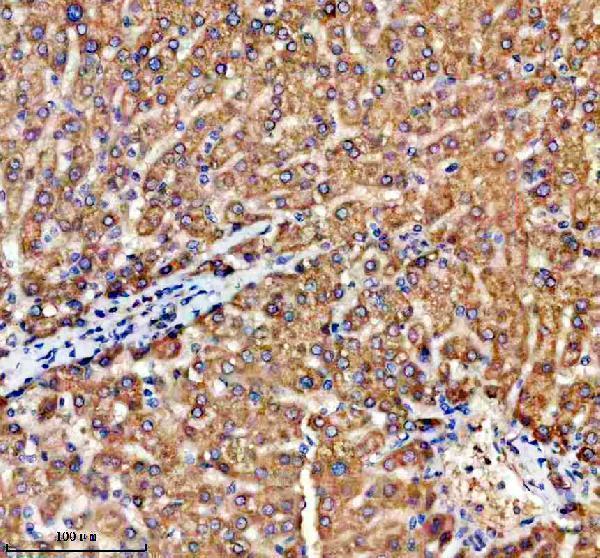 a07207 2 trim59 primary antibodies ihc testing 3