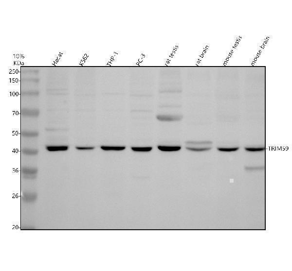 Western blot analysis of TRIM59 using anti-TRIM59 antibody (A07207-2)
