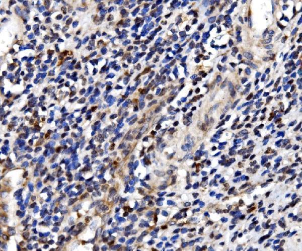a07208 1 psmc3 primary antibodies ihc testing 3