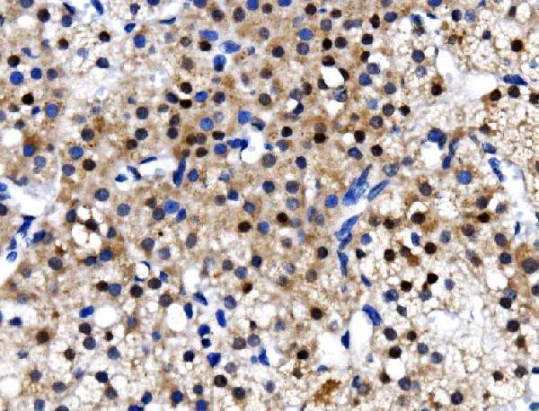 a07208 1 psmc3 primary antibodies ihc testing 4