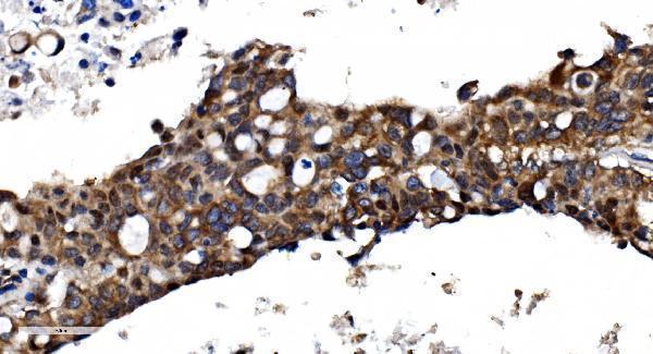 a07208 1 psmc3 primary antibodies ihc testing 6